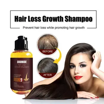 100 МЛ Кондиционера для роста волос Нежирный Шампунь для роста волос Натуральный Предотвращает выпадение волос Шампунь для роста волос для мужчин